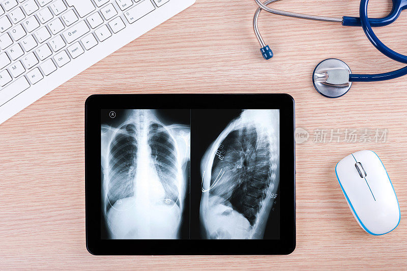 远程医疗:带听诊器和胸部x光片的数字平板电脑