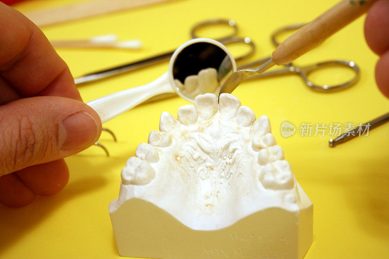 牙齿矫正医师的牙齿模型