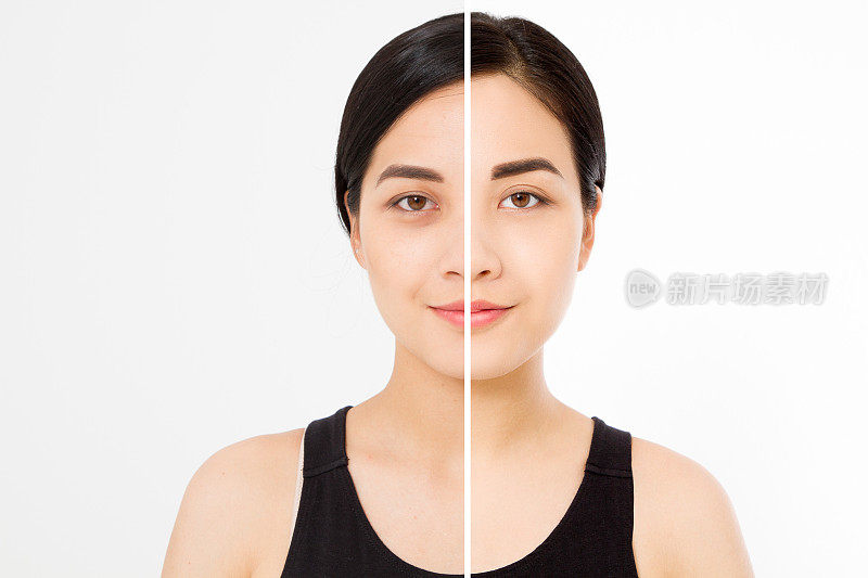 亚洲女性面孔前后特写。整容前后对比。皮肤护理皱纹脸，黑眼圈。前后抗衰老整容治疗。面部护肤美容轮廓
