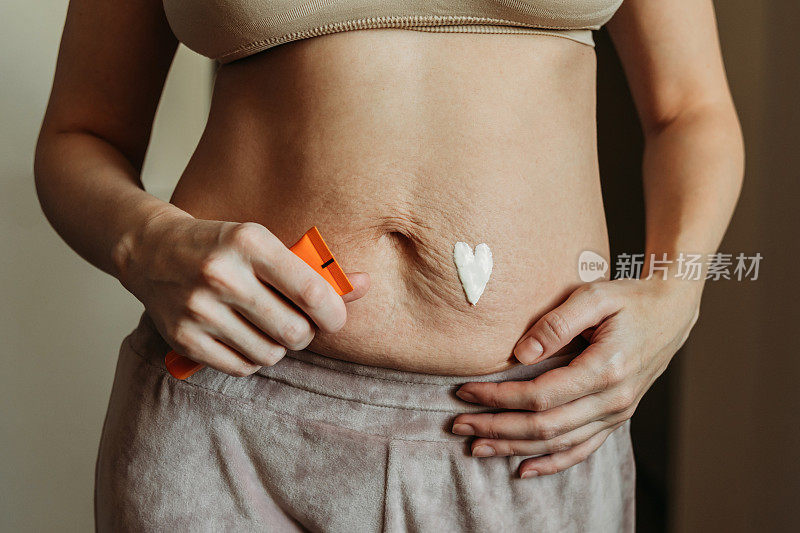 一名年轻女子怀孕后在她满肚子妊娠纹的肚子上涂了药膏。
