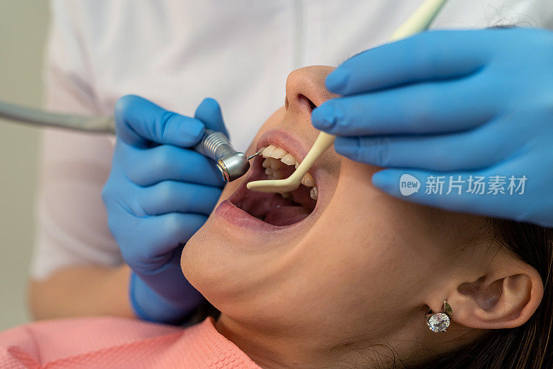 牙医医生用牙钻治疗病人的龋齿