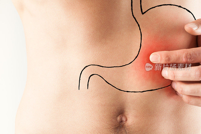 胃痛-病人显示的区域