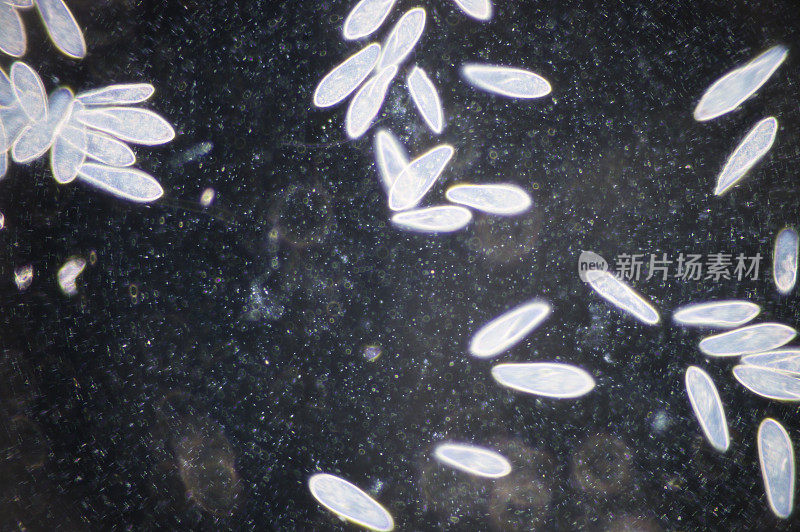 草履虫是一种单细胞纤毛原生动物