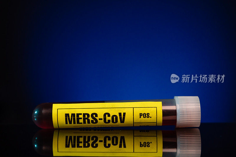 MERS-CoV病毒血样检测管特写黄色标记，蓝色背景