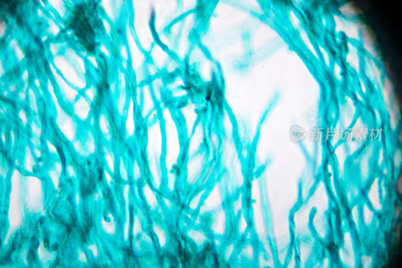 青霉菌在显微镜