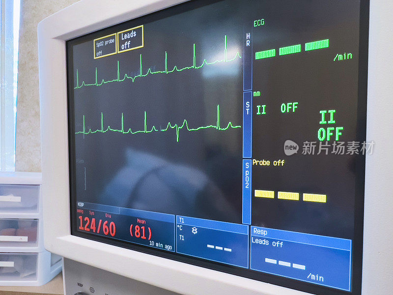 医院设备监测重要功能(生命体征)监测在手术室的照片系列