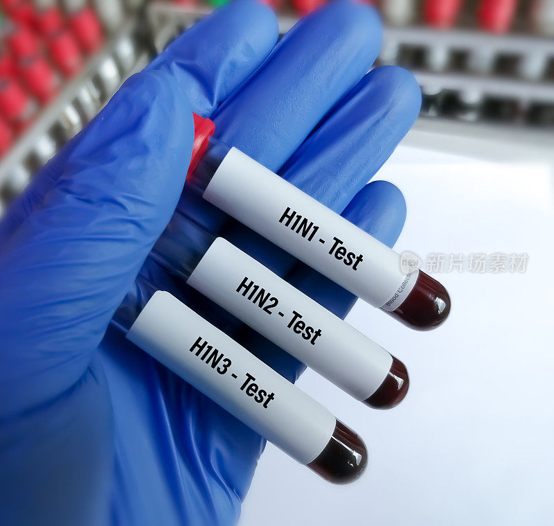 科学家血液样本用于甲型流感病毒亚型H1N1、H1N2和H1N3的检测。