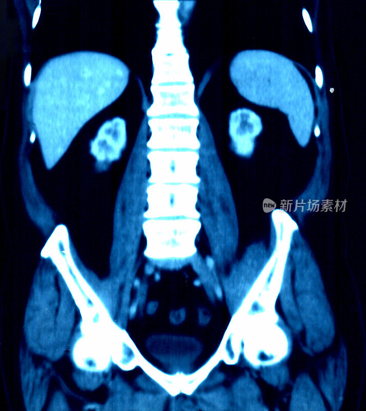 用于医生检查的冠状x线图像