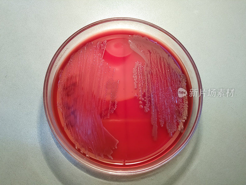 医学微生物实验室血琼脂培养基上的细菌生长。