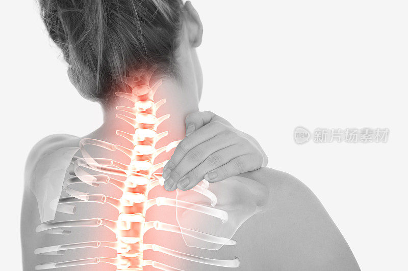 颈部疼痛的女性脊椎突出