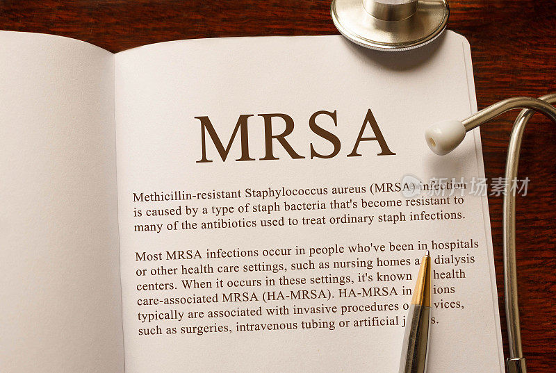 页有MRSA耐甲氧西林金黄色葡萄球菌感染的表用听诊器，医学概念
