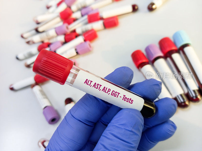 实验室用血样管作肝功能(谷丙转氨酶(ALT)、谷草转氨酶(AST)、碱性磷酸酶(ALP)、谷丙转氨酶(GGT))检测，诊断和监测肝脏疾病。