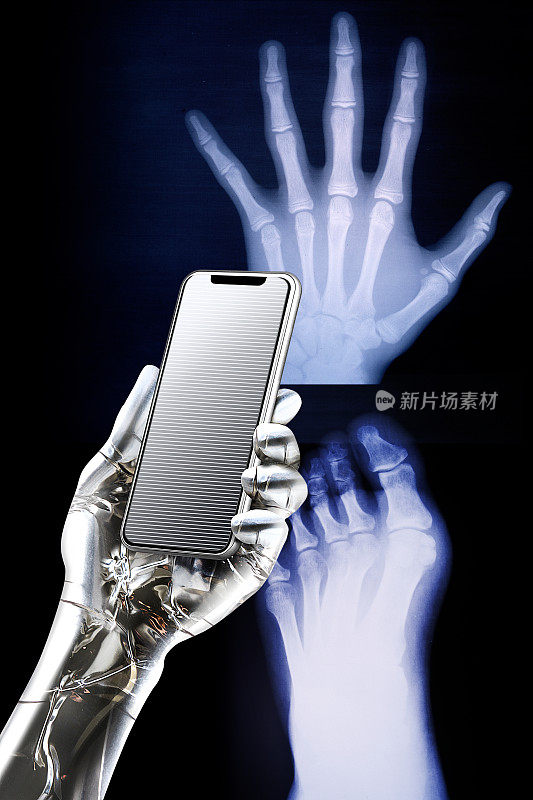 一个金属人工智能机器人，在观察手和脚的X光照片的同时，用iPhone检查结果。