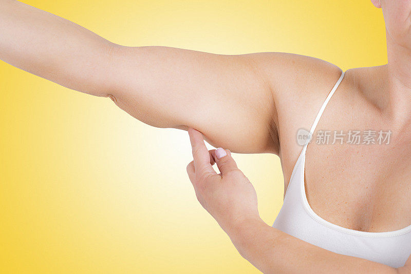 女性手臂的脂肪组织和松弛的皮肤