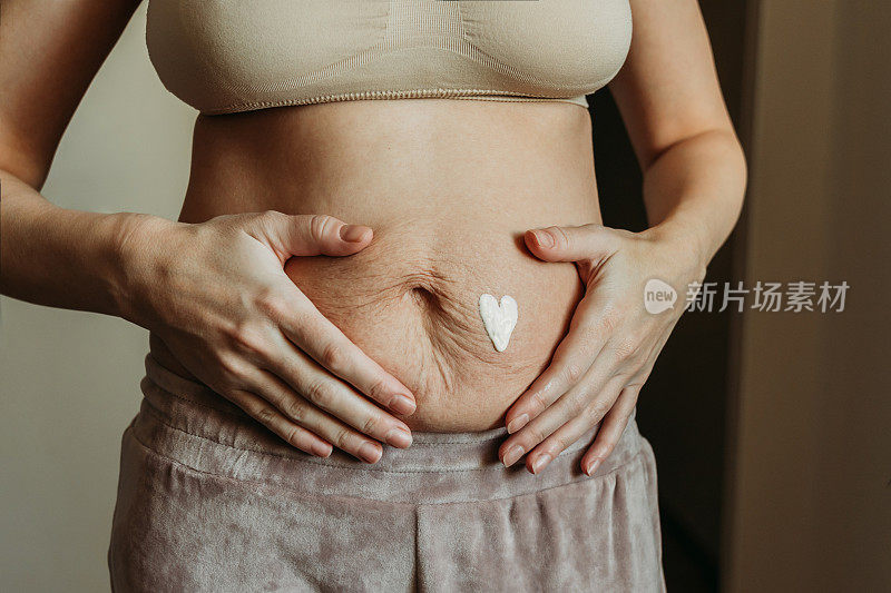 一名年轻女子怀孕后在她满肚子妊娠纹的肚子上涂了药膏。
