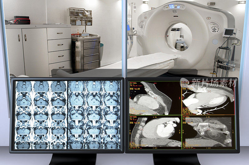 高清晰度CT扫描仪