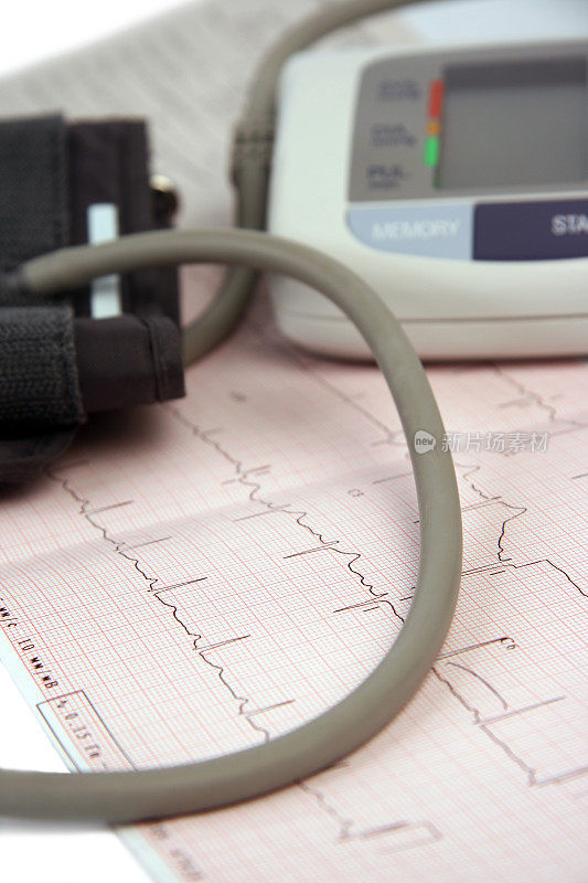 心电图上的血压计