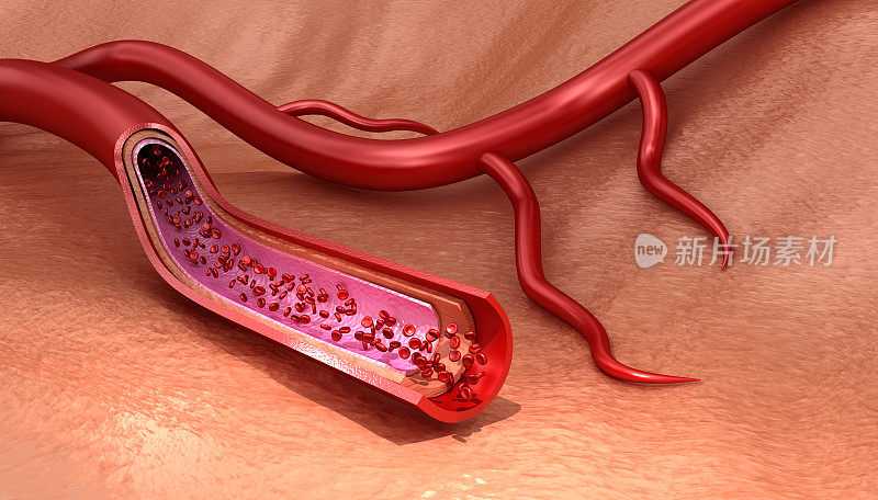 血管切片宏红细胞，医学上精确的3D插图