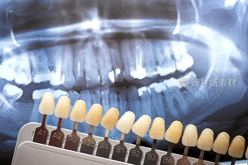 牙科医生用x光检查牙齿