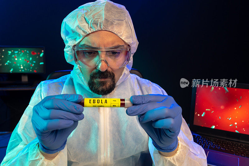 实验室科学家在实验室观察埃博拉病毒血液样本，特写