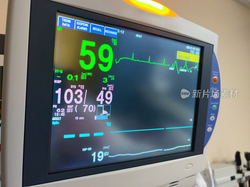 监测生命体征，心电图，心电图医疗中心照片系列