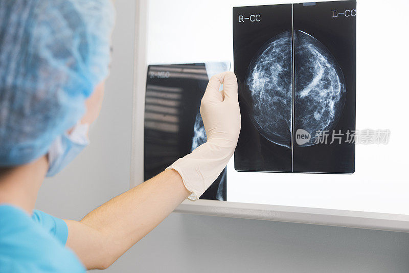 身着手术服的女医生或护士正拿着一张乳房x光片站在x光照明灯前