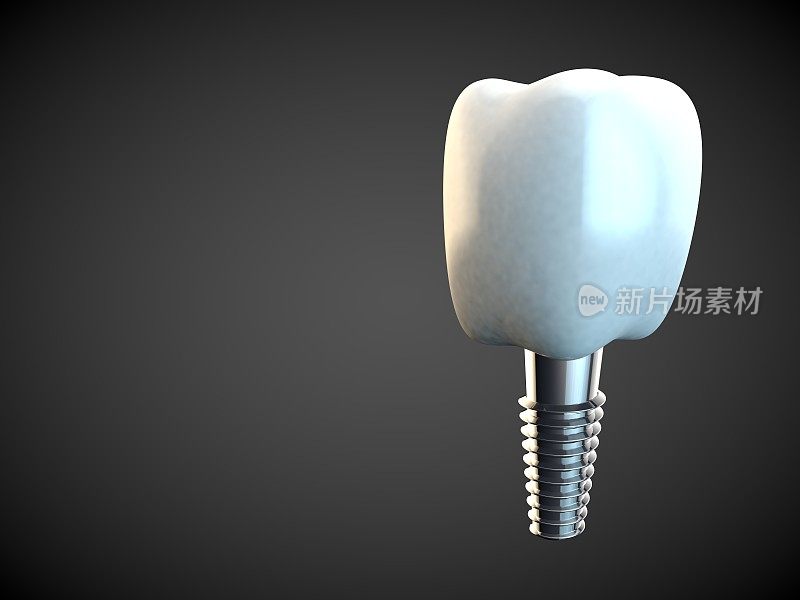 牙磨牙种植牙卫生牙医3D黑色