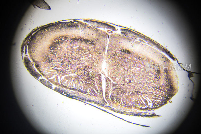 显微镜下脊髓横切面
