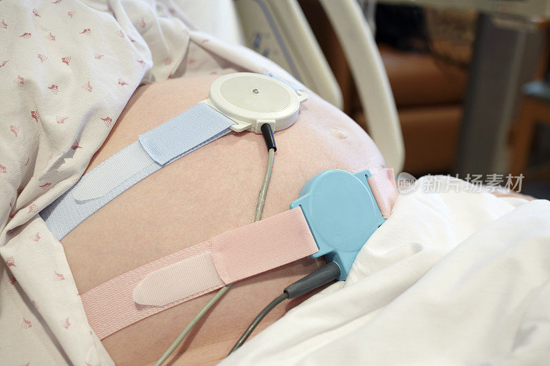 孕妇腹部胎儿监测传感器