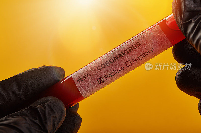 检测COVID-19试管血液样本冠状病毒阳性框