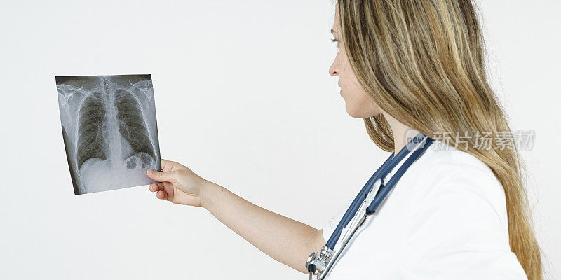 医学健康理念。一位年轻的女医生正在检查一张人体胸部的x光照片。