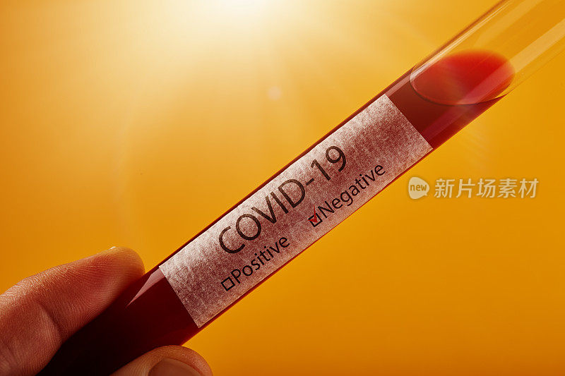 检测COVID-19试管血液样本冠状病毒阳性框