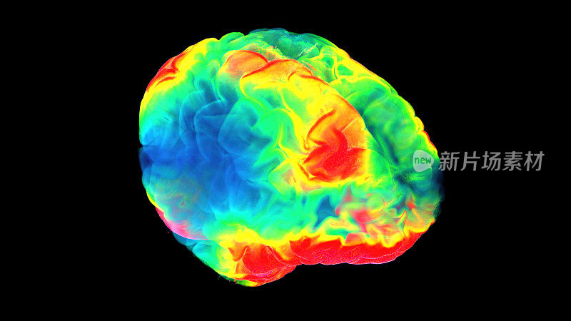 基于计算机断层扫描(CT)获得的大脑三维模型，提出了一种新的脑成像方法。在这种可视化的帮助下，你可以得到大脑工作的更详细的图像。