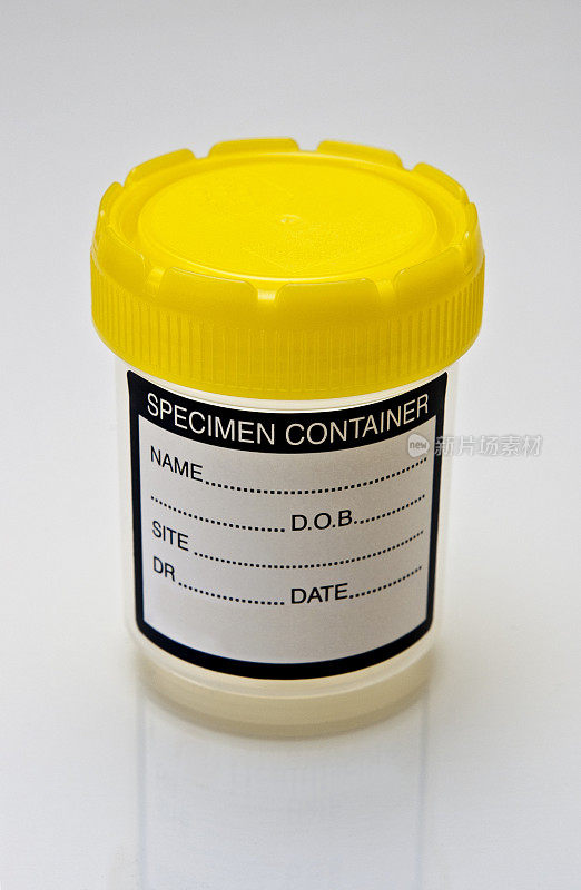 尿液标本的容器