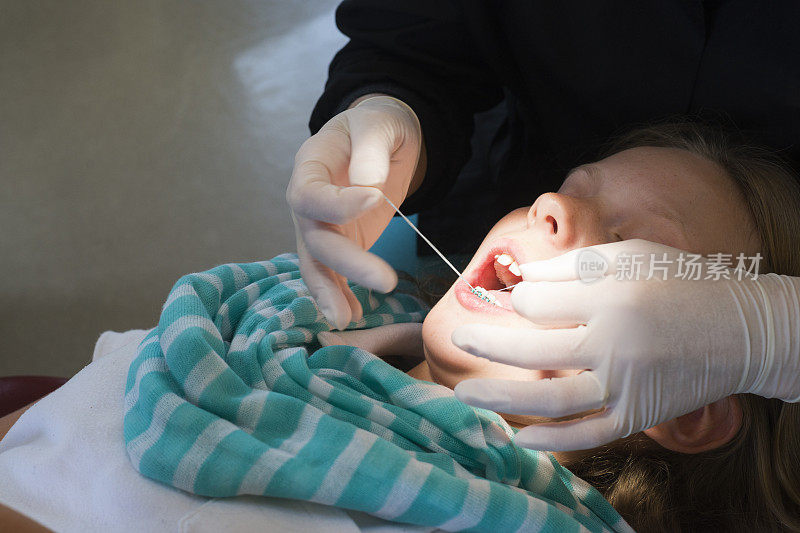 牙科助手用牙线清洁病人的牙齿