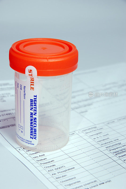 医用尿液标本瓶