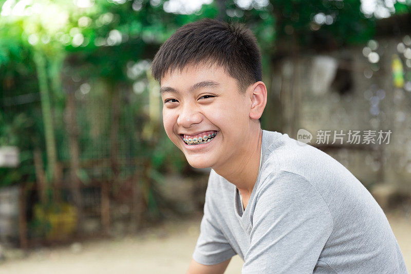 美丽的微笑英俊的男孩用牙齿支撑牙齿。