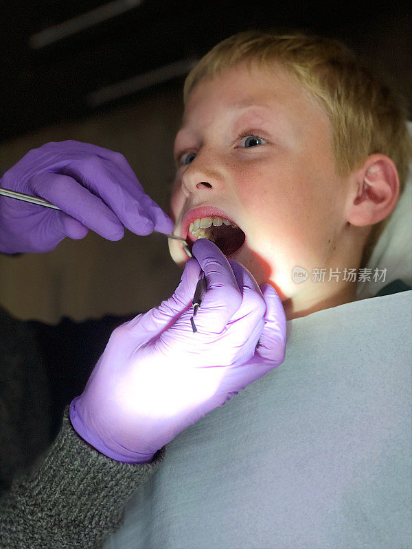 牙医给一个男孩拔牙