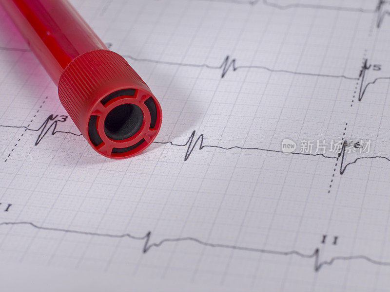 真实心电图和新型冠状病毒血试管没有人。