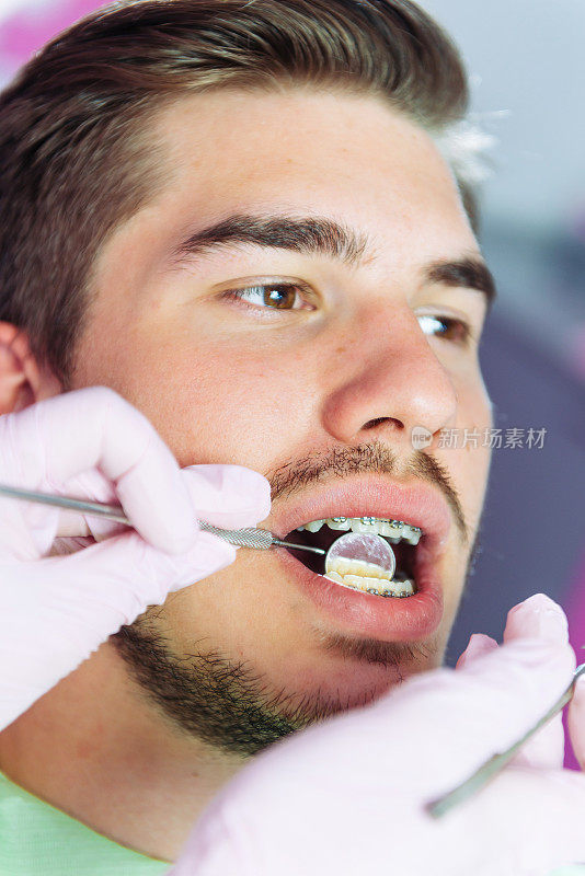 戴牙套的年轻人正在看牙医