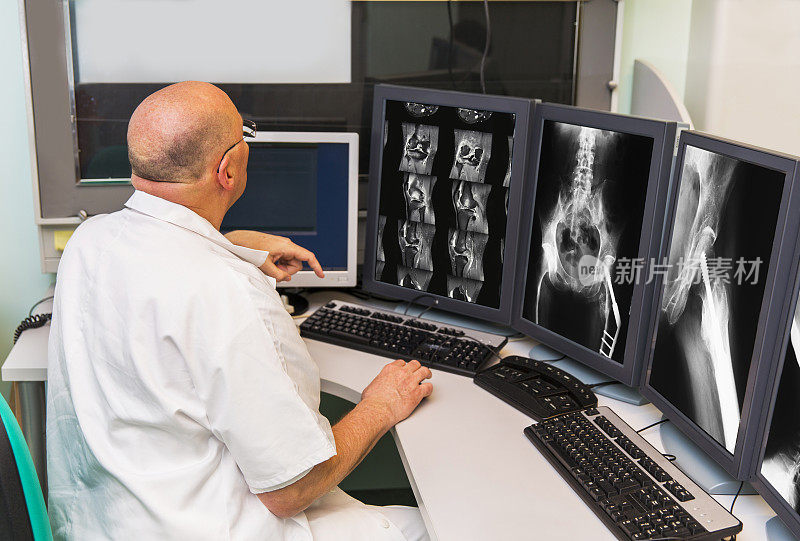 肿瘤学研究所高级放射科医师正在检查MRI扫描