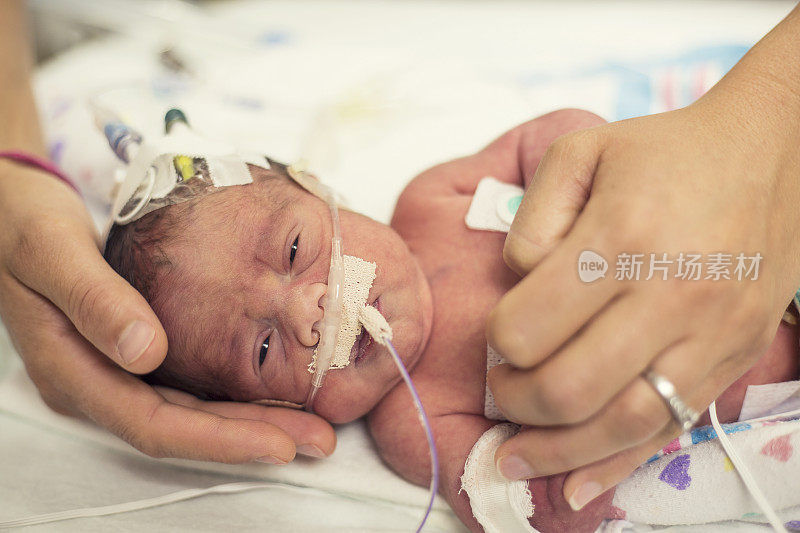 新生儿早产儿重症监护室