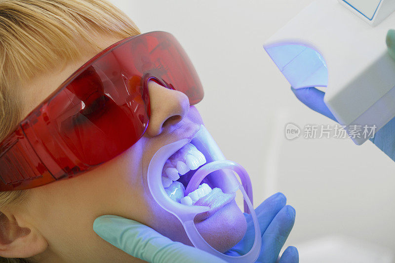 牙科牙医工作牙齿美白牙科医疗过程