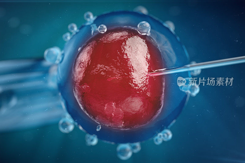 体外受精，将精子注入卵细胞，辅助生殖治疗。
