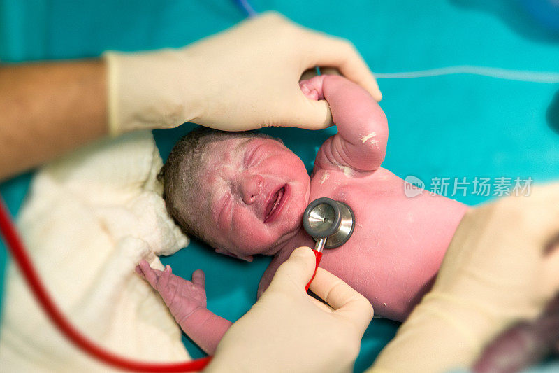全新的婴儿。刚出生的女婴正在接受医生的检查
