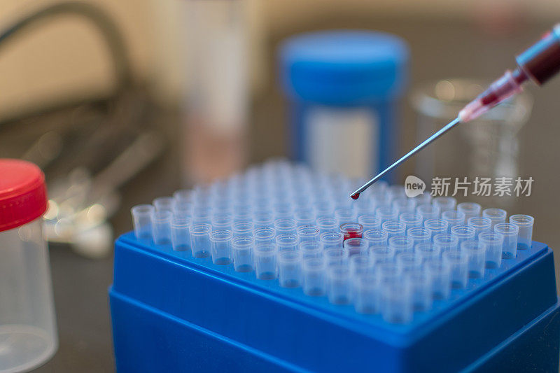 科学实验室注射器里的血