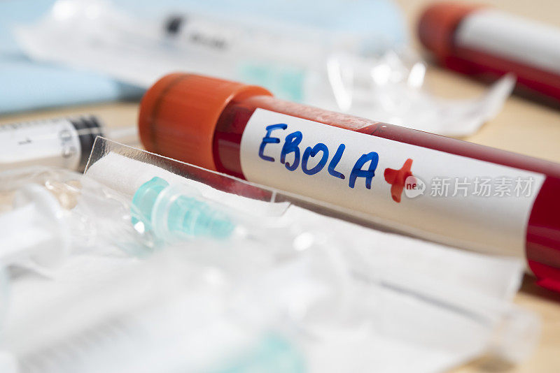 有埃博拉标签的血管