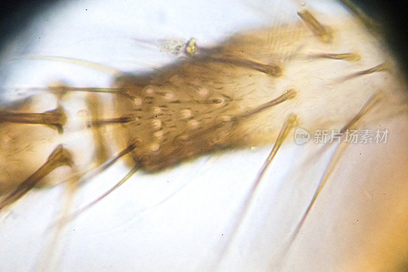 蚊子-显微镜下的雌性腿