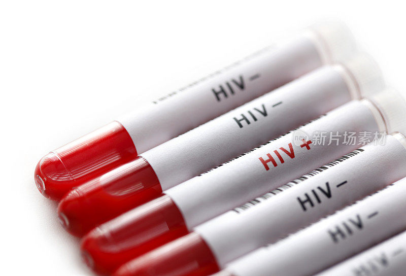 艾滋病毒测试