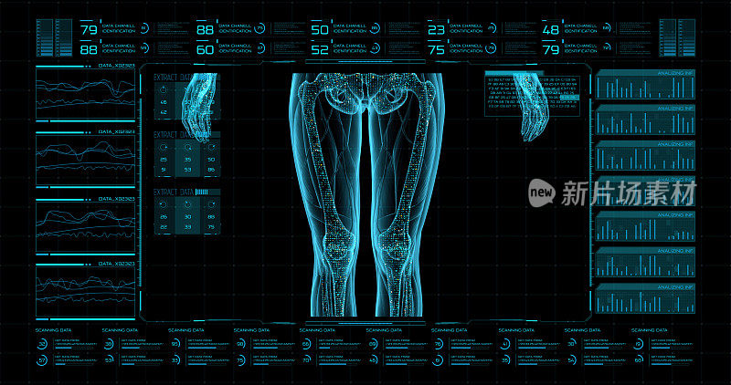 未来医疗程序的hud界面是一个扫描控制面板(MRI)与数字三维可视化的骨骼，以及周围的软组织。